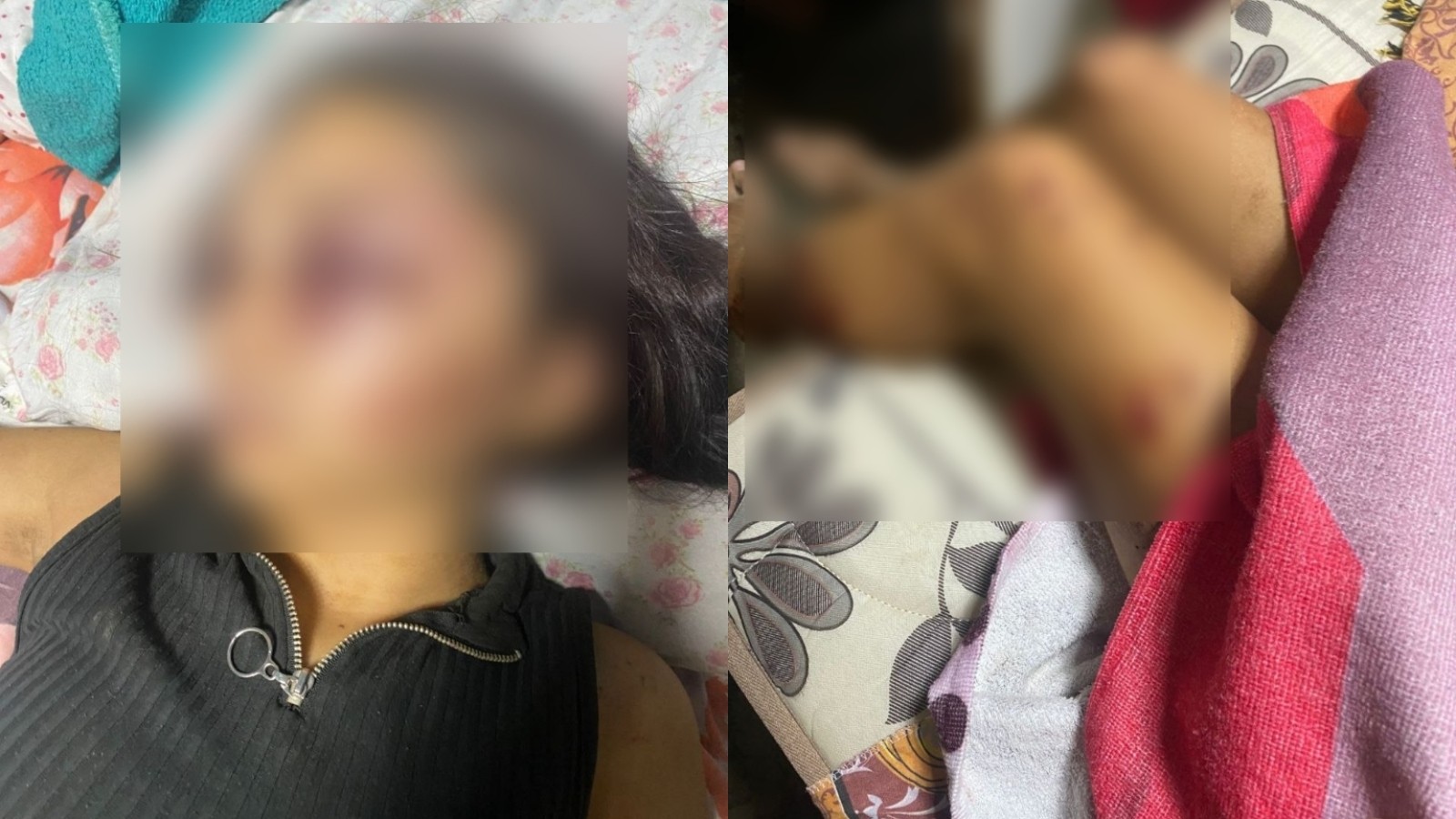 Acusado de brutal agressão contra Adolescente é encontrado morto no CE