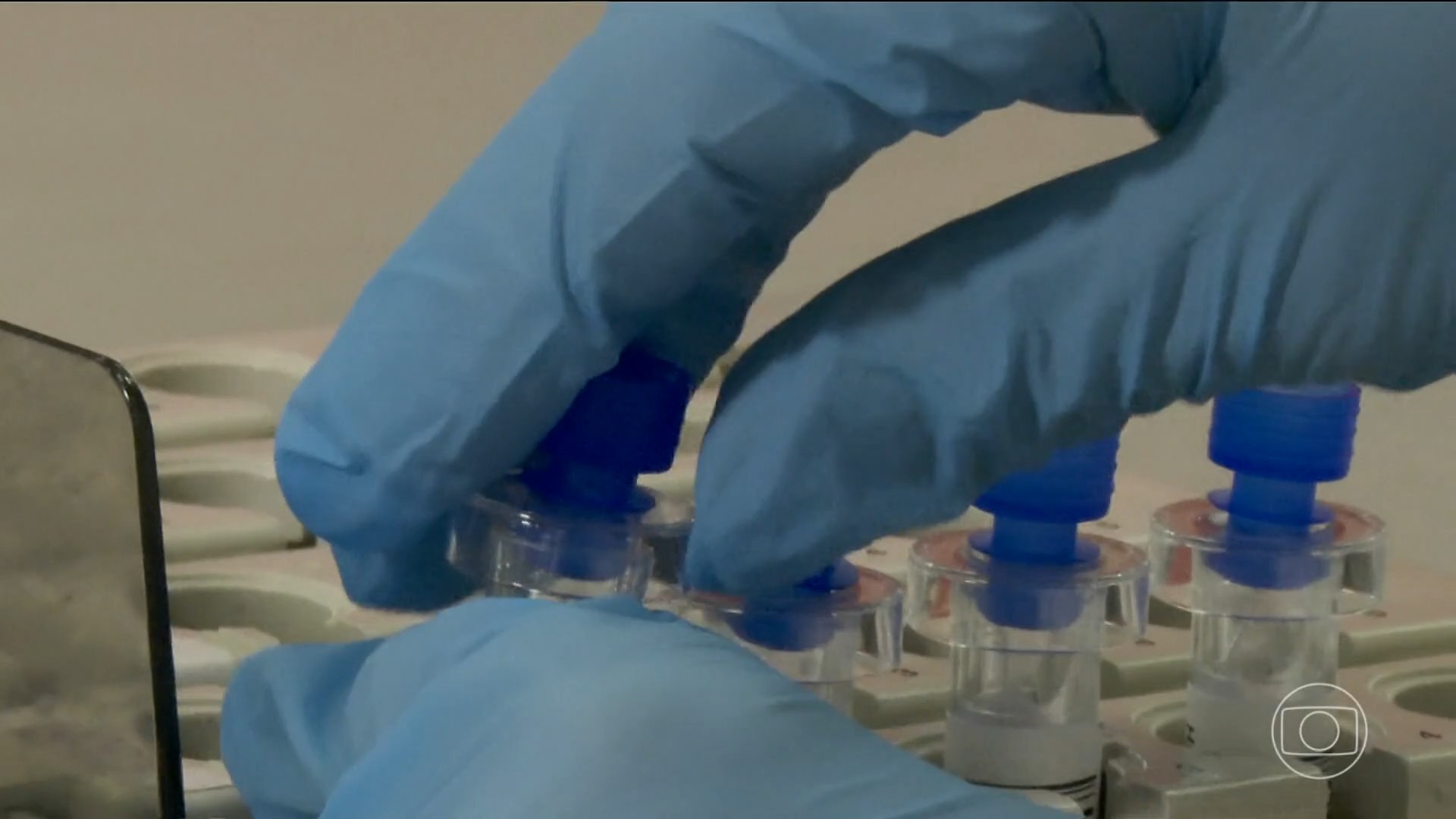 SUS implementa teste genético para identificar risco hereditário de câncer de mama