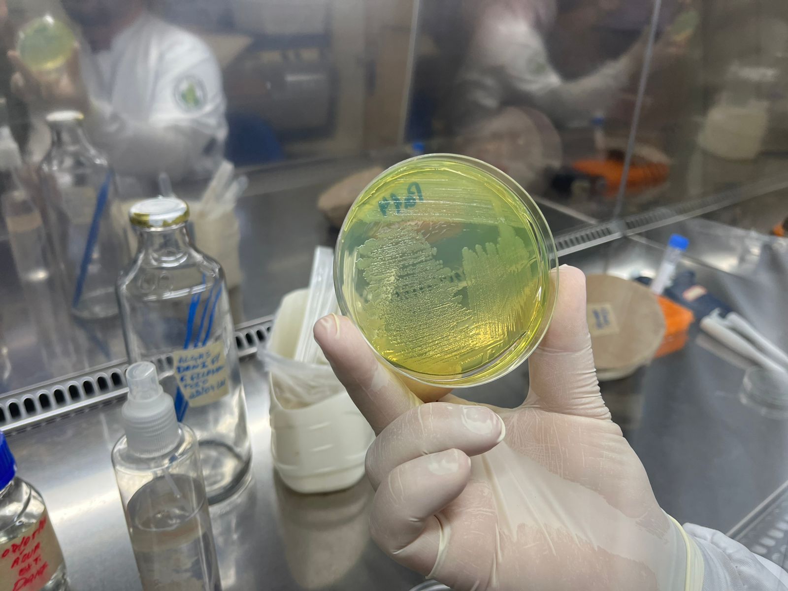 UFRN alerta para risco de bactéria resistente em produtos Ypê