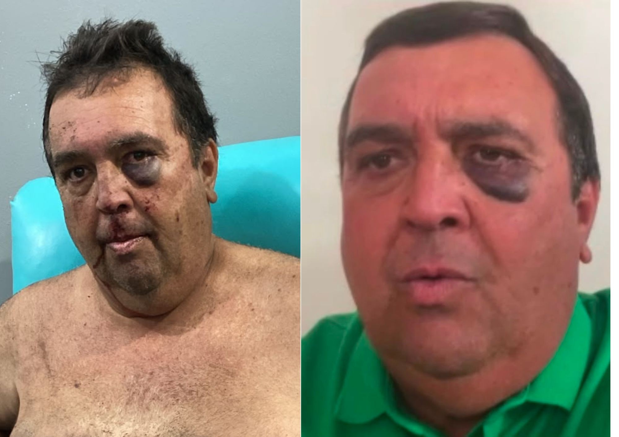 Vereador de Lagoa Salgada é sequestrado e agredido em Brejinho